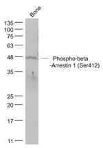 Phospho-beta Arrestin 1Ser412 (Ser412) Antibody in Western Blot (WB)