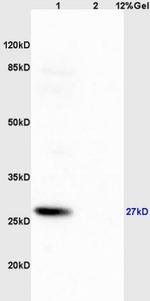 Phospho-RPS6 (Ser235, Ser236) Antibody in Western Blot (WB)