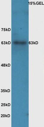 Phospho-IL-1R1 (Tyr496) Antibody in Western Blot (WB)