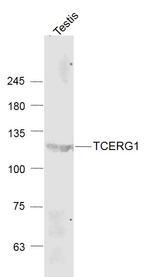 TCERG1 Antibody in Western Blot (WB)