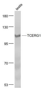 TCERG1 Antibody in Western Blot (WB)
