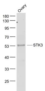 STK3+STK4 Antibody in Western Blot (WB)