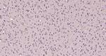 EGR2 Antibody in Immunohistochemistry (Paraffin) (IHC (P))