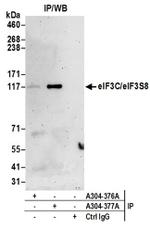 eIF3C/eIF3S8 Antibody in Western Blot (WB)