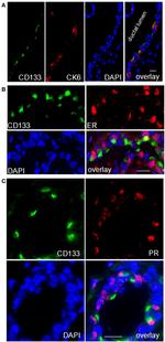 CD133 (Prominin-1) Antibody in Immunohistochemistry (IHC)
