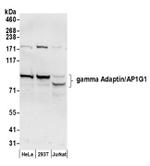 gamma Adaptin/AP1G1 Antibody in Western Blot (WB)
