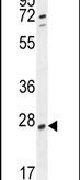 RPEL1 Antibody in Western Blot (WB)