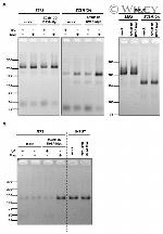 c-Myc Antibody in Immunoprecipitation (IP)