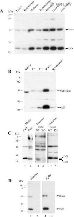 Connexin 29 Antibody in Western Blot (WB)