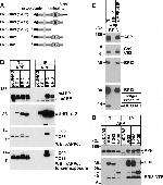 beta Amyloid Antibody in Western Blot, Immunoprecipitation (WB, IP)
