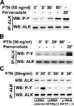 ALK Antibody in Western Blot, Immunoprecipitation (WB, IP)