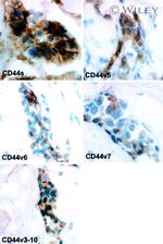 CD44var (v3-v10) Antibody in Immunohistochemistry (IHC)