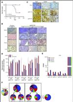 CD30 Antibody in Immunohistochemistry (IHC)