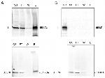 HPV Type 16 L1 Antibody in Immunoprecipitation (IP)