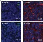 Rat IgG (H+L) Cross-Adsorbed Secondary Antibody in Immunohistochemistry, Immunohistochemistry (Frozen) (IHC, IHC (F))