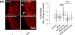 Rat IgG (H+L) Cross-Adsorbed Secondary Antibody in Immunohistochemistry, Immunohistochemistry (PFA fixed) (IHC, IHC (PFA))