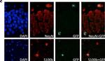 Rabbit IgG (H+L) Cross-Adsorbed Secondary Antibody in Immunohistochemistry (Paraffin) (IHC (P))