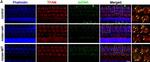 Rabbit IgG (H+L) Highly Cross-Adsorbed Secondary Antibody in Immunohistochemistry (IHC)
