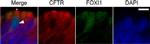 Mouse IgG (H+L) Secondary Antibody in Immunohistochemistry (IHC)