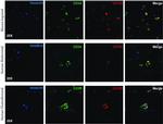 CD105 (Endoglin) Antibody in Immunohistochemistry (IHC)