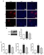 NFkB p65 Antibody in Immunohistochemistry (IHC)