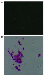 Borrelia burgdorferi Antibody in Immunocytochemistry (ICC/IF)