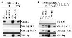 Estrogen Receptor beta Antibody in Western Blot (WB)
