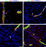 Neural/Glial Antigen 2 (NG2) Antibody in Immunohistochemistry (IHC)