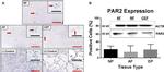 PAR2 Antibody in Western Blot, Immunohistochemistry (WB, IHC)
