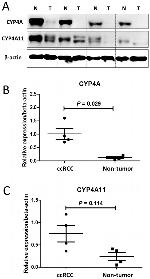 CYP4A11 Antibody in Western Blot, Immunohistochemistry (WB, IHC)