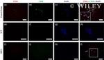 CD90 (Thy-1) Antibody in Immunocytochemistry (ICC/IF)