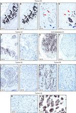 Cytokeratin 15 Antibody in Immunohistochemistry (IHC)