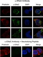 alpha-ENaC Antibody in Immunocytochemistry (ICC/IF)