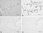 beta Amyloid (1-40) Antibody in Immunohistochemistry (IHC)