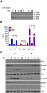 Estrogen Receptor Beta Antibody in Western Blot, Immunoprecipitation (WB, IP)
