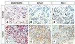 CD279 (PD-1) Antibody in Immunohistochemistry, Immunohistochemistry (Frozen) (IHC, IHC (F))