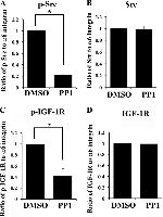 Phospho-IR/IGF1R (Tyr1158, Tyr1162, Tyr1163) Antibody in Western Blot (WB)