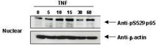 Phospho-NFkB (RelA) (Ser529) Antibody in Western Blot (WB)