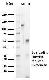 N-Cadherin/Cadherin-2/CD325 (NCAD) Antibody in SDS-PAGE (SDS-PAGE)