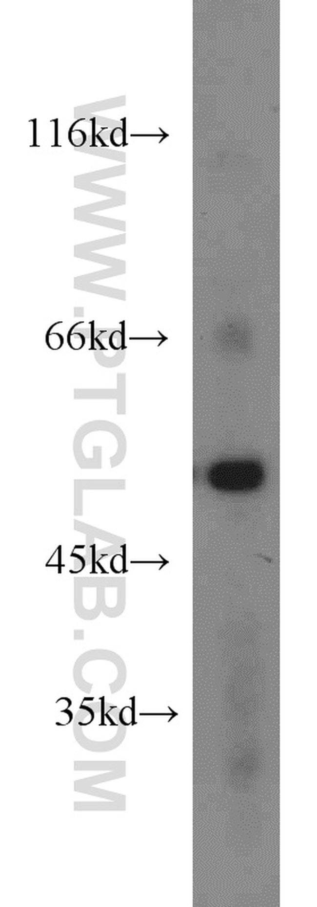 Dynamitin (1-86 AA) Antibody in Western Blot (WB)