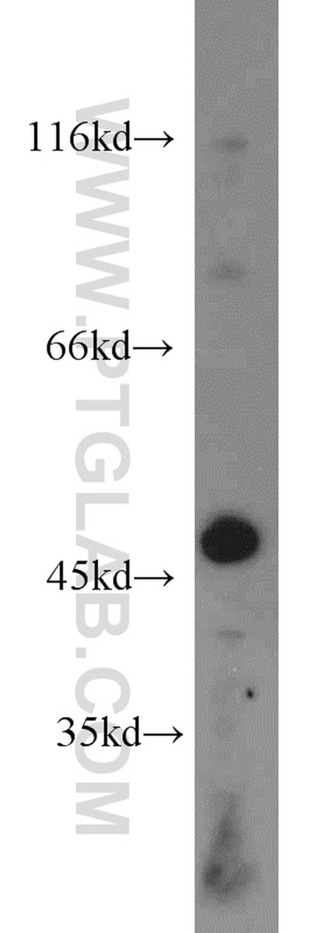 Dynamitin (1-86 AA) Antibody in Western Blot (WB)