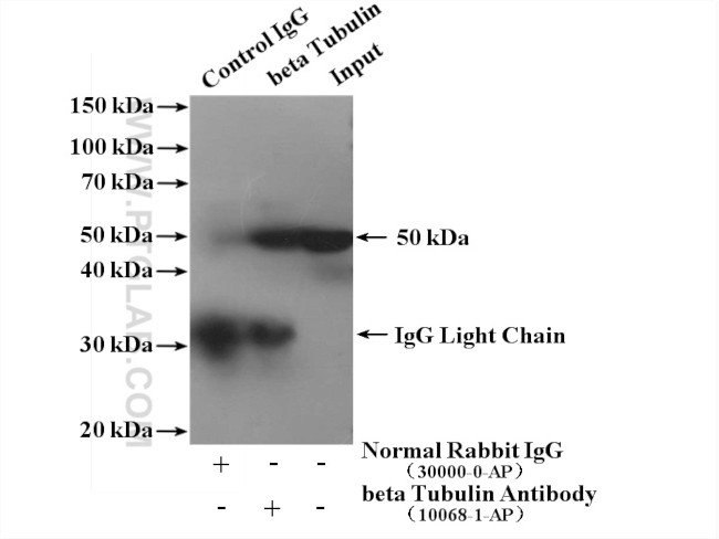 beta Tubulin Antibody in Immunoprecipitation (IP)