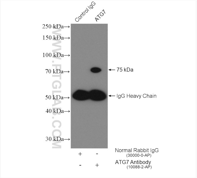 ATG7 Antibody in Immunoprecipitation (IP)