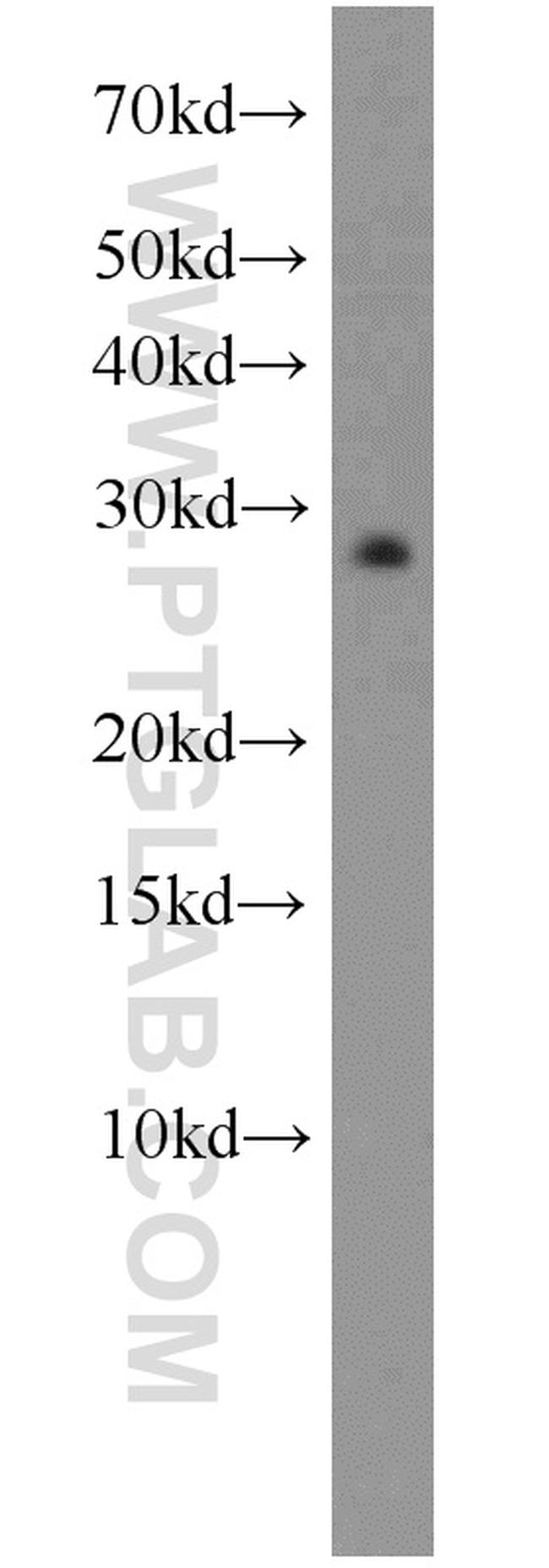 EEF1B2 Antibody in Western Blot (WB)