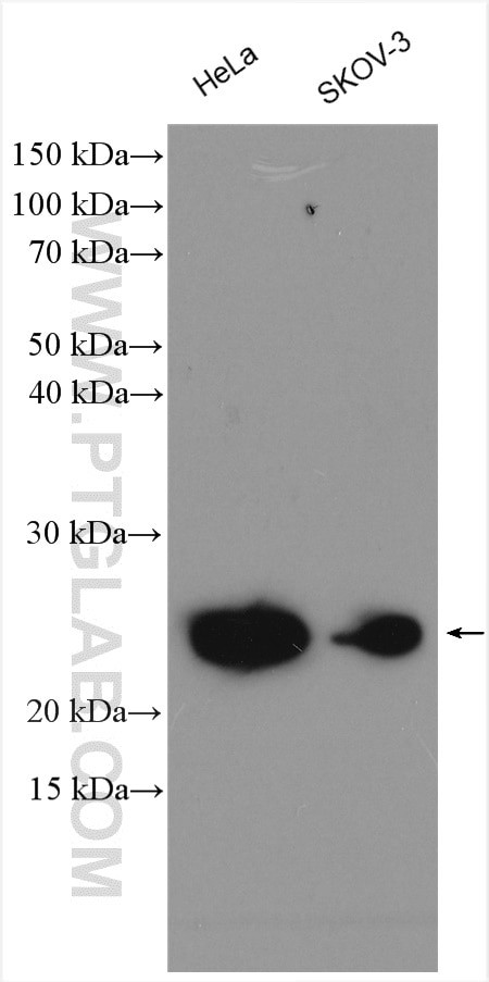 UBE2T/HSPC150 Antibody in Western Blot (WB)
