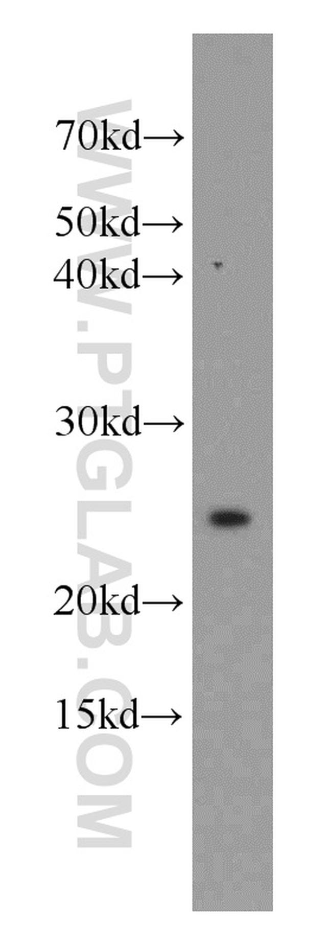 UBE2T/HSPC150 Antibody in Western Blot (WB)