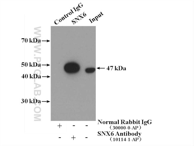 SNX6 Antibody in Immunoprecipitation (IP)