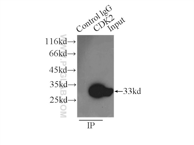 CDK2 Antibody in Immunoprecipitation (IP)