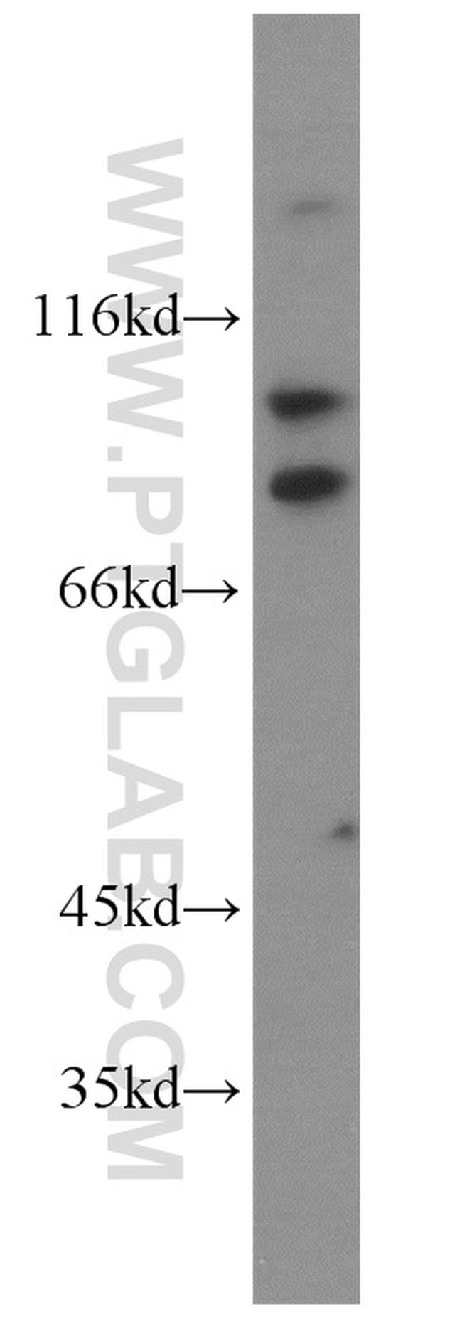 KIFC3 Antibody in Western Blot (WB)
