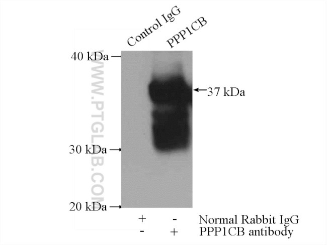 PPP1CB Antibody in Immunoprecipitation (IP)